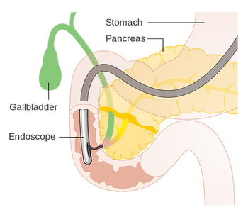 ERCP Diagram